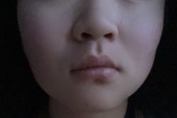 点击看大图 体验前-石家庄苏亚美联臣医疗美容医院
