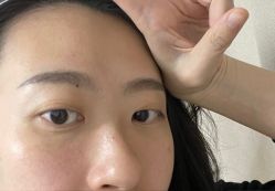 体验后-深圳美莱医疗美容医院