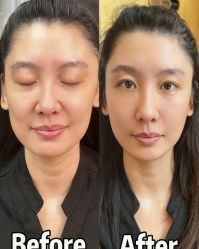 -颜和骨正&明星徒手小颜整骨