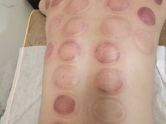 -感智盲人按摩·艾灸·肩颈SPA(岗厦店)