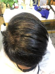 -髻尚坊增发补发织发假发定制