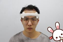 点击看大图 -大麦微针植发丨全国连锁