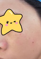 体验后-苏州卫康美容医院