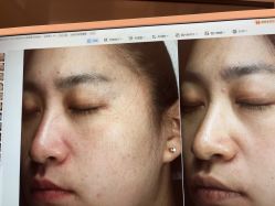 -苑苑vbeauty科技美容SPA