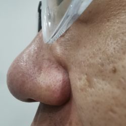 -苗方清颜专业祛痘·皮肤管理