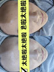 -SKIN79皮肤管理中心