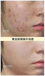 -LUNA皮相美·骨相美高级美感