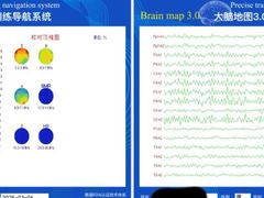 -金博智慧注意力感统训练(望京校区)