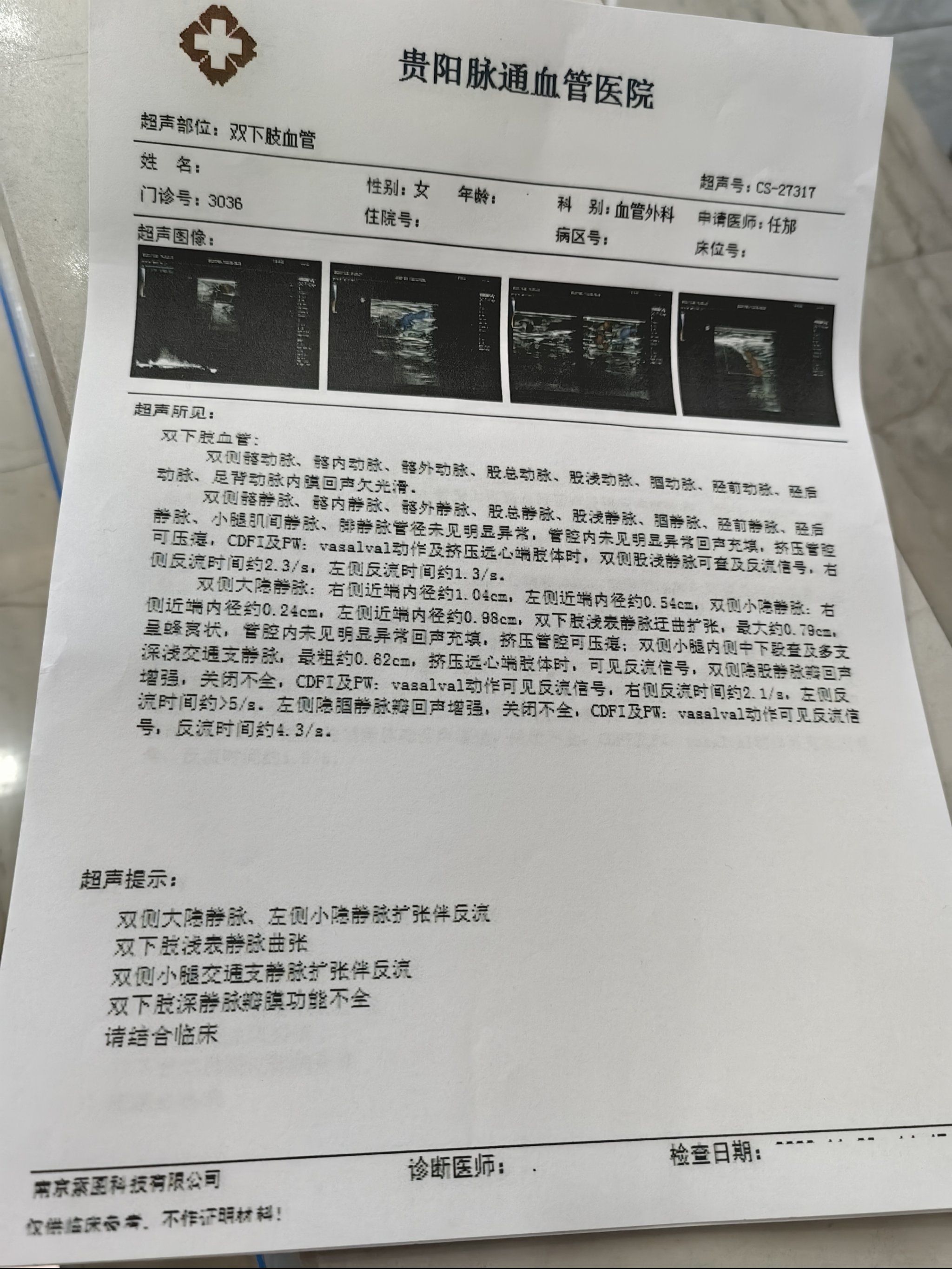记录在贵阳看静脉曲张的过程