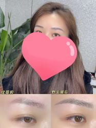 -OnFaer.纹眉半永久无创洗眉