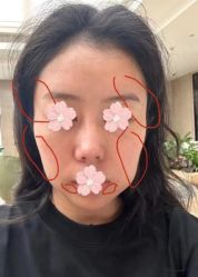 -素美医疗美容·西南眼鼻整形·修复基地