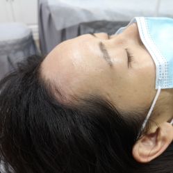 -西施无菌半永久纹绣眉眼影唇轻增发纹发际线