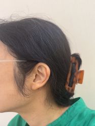 -长沙雅美医疗美容医院