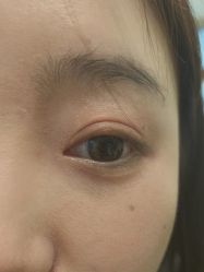 点击看大图 -Yestar艺星整形美容医院