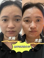 -伊丽莎白医疗美容