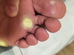 -朋朋修脚(友好广场店)