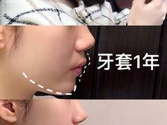 -极光口腔·矫正种植修复(锦江店)