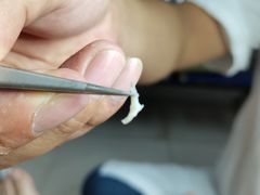 -新甲连锁灰指甲·甲沟炎·鸡眼(黑龙江路店)