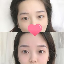 -久匠半永久纹眉