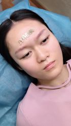 点击看大图 -郡艺医疗美容·微整·眼鼻吸脂