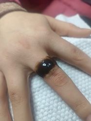 -净肤洗纹身