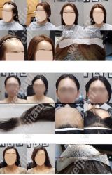 -发饰美男士增发补发假发定制店