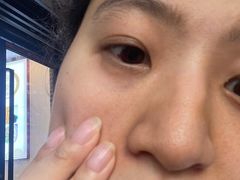 -上海大学附属上海和平眼科医院
