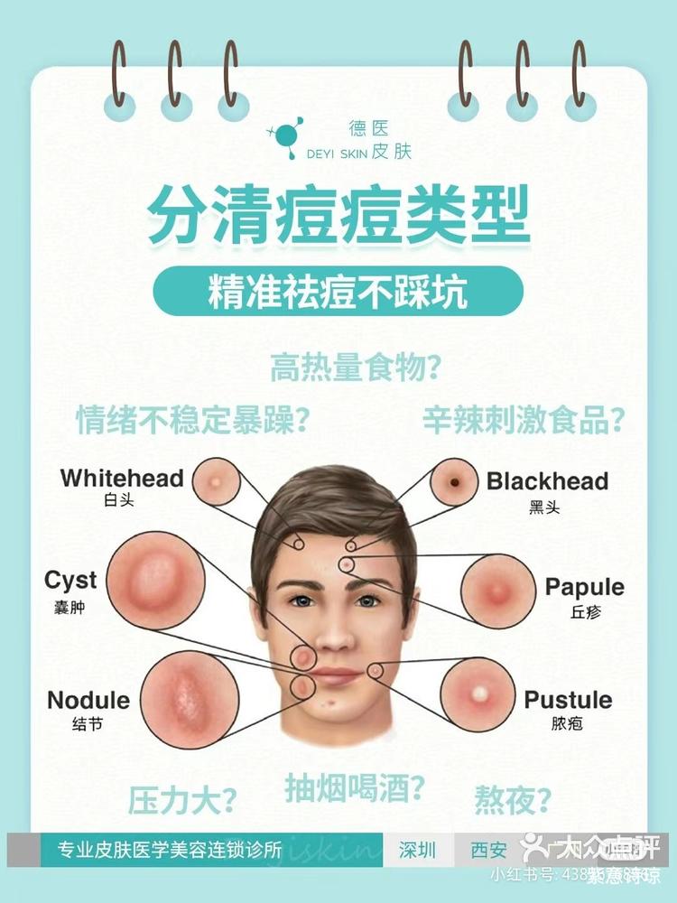 一般常见的痘痘类型分为: x 闭口粉刺-大众点评