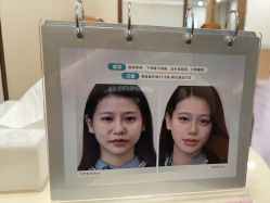 点击看大图 -广州紫馨整形外科医院