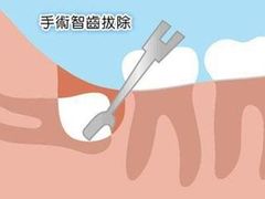 -团圆口腔·种植中心(锦江院区)