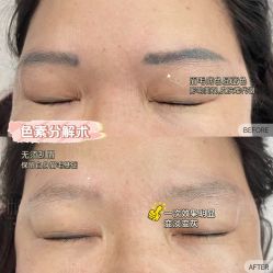 -郡艺医疗美容·微整·眼鼻吸脂