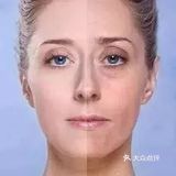 解忧:卵巢功能下降如何调理?吃什么保养卵巢最好?