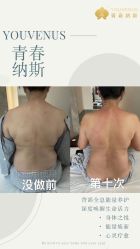 -半岛故事·法儿曼抗衰·indiba中心