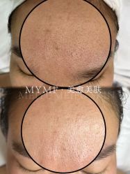 -美愈美肤MEIYU SKIN