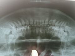 android_upload_pic-广州市海珠区口腔医院