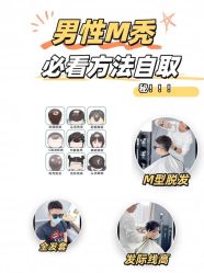 点击看大图 -极客侠男士假发定制补发