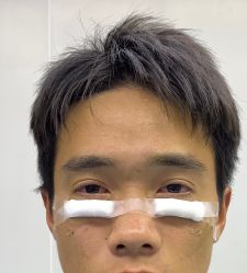 -天津健丽·去眼袋医疗美容机构