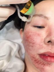 -上海漾颜医疗美容
