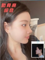 -北京米扬丽格医疗美容·联合丽格鼻整形中心