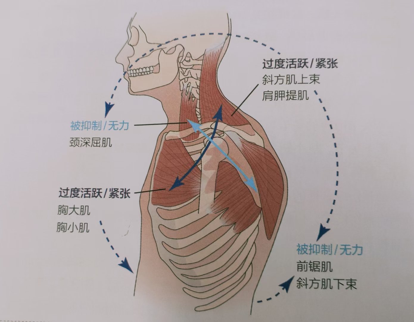 肩周粘连绝招图片