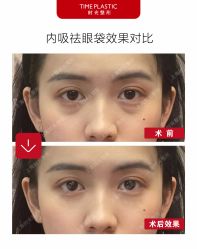 -上海时光整形外科医院