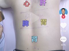 -57号足浴