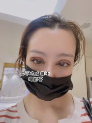 体验后-铂特丽医美·眼鼻整形·光电美肤·注射抗衰