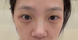 -长沙雅美医疗美容医院