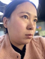 体验后-亿美医疗美容·半岛大超炮官方授权店