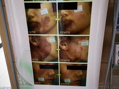 -安徽医科大学第一附属医院(绩溪路院区)