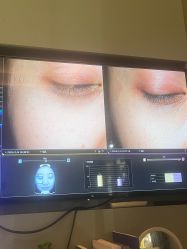 -苑苑vbeauty科技美容SPA