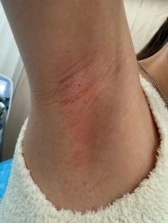 -南宁华美医疗美容医院