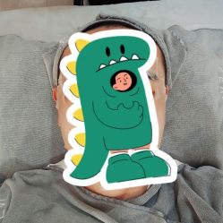 体验后-ST时柒·问题肌抗衰美颜所