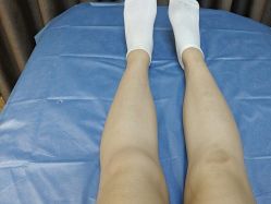 体验后-广州美莱医疗美容医院
